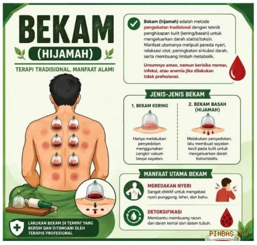 Tanya jawab: Apa itu Bekam? Alhijamah? Apakah terapi sehat dan baik untuk laki laki dan perempuan?